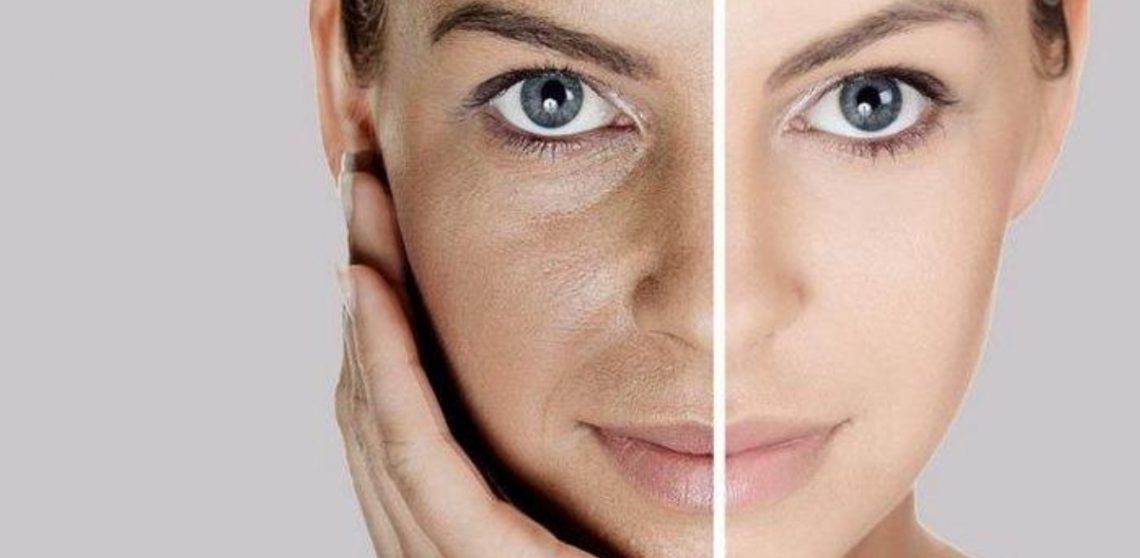 facial